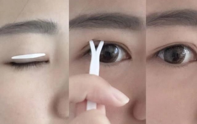 三眼皮显老气吗,三眼皮真的很好看吗