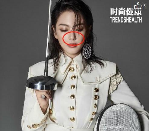 张雨绮回应鼻子一大一小不对称,张雨绮现在的鼻子怎么了
