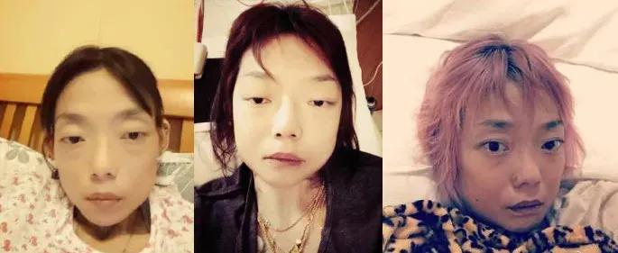 她嫁入豪门八年为挽留丈夫瘦44斤,她22岁嫁入豪门8年后骨瘦如柴