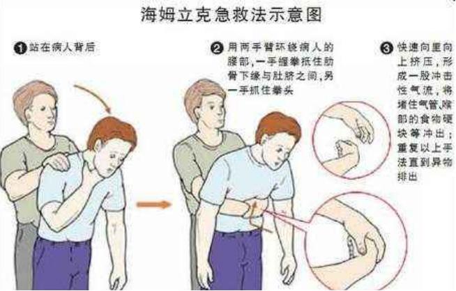 宝宝喉咙卡东西急救方法视频,小孩喉咙卡了异物怎么办小妙招