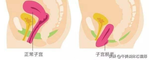 宝妈小腹突出怎么锻炼,宝妈肚子怎么练都紧致