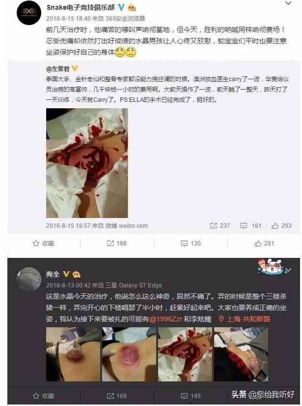 电竞选手得腱鞘炎还能恢复吗,电竞选手容易得腱鞘炎还是肌腱炎