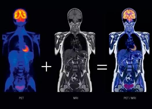 哈医大一院磁共振有片吗,哈医大一院能做内耳磁共振吗