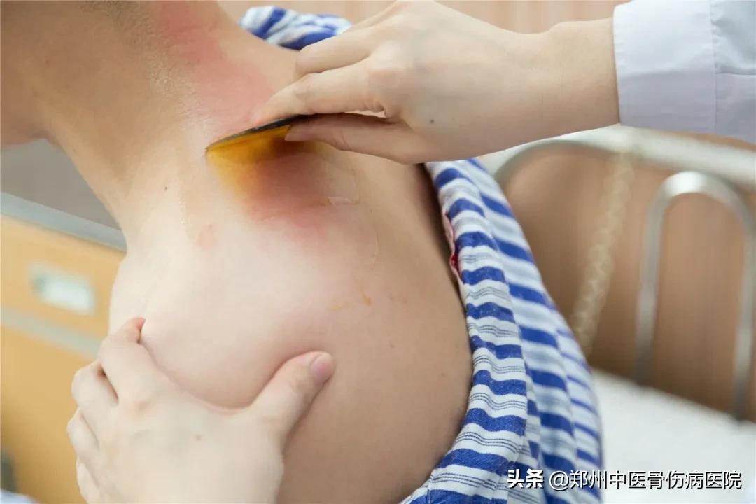 郑州骨伤病医院怎么样,中医骨伤郑州