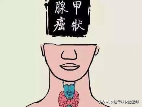 甲状腺亚甲炎右侧疼能自愈吗,甲状腺引起的不适