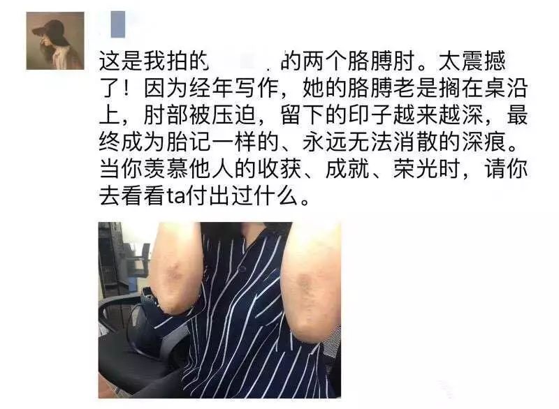 没病到一定程度，千万别去做自由职业者