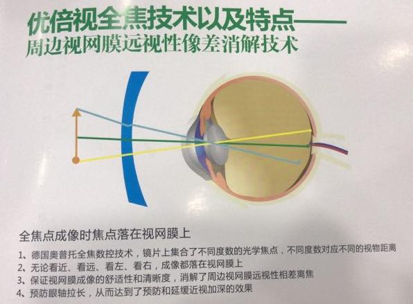优倍视——专注青少年儿童近弱视防控，许昌店提供优质服务