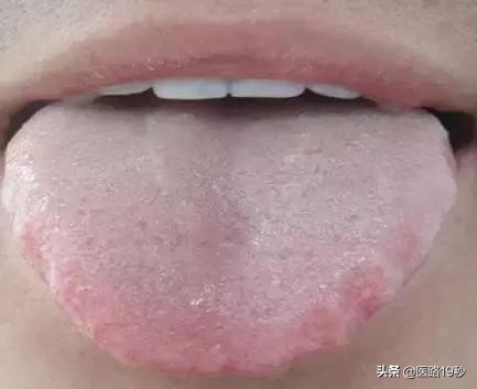 蒲公英茶真的能护肝吗女性,蒲公英菊花决明子茶养肝护肝测评