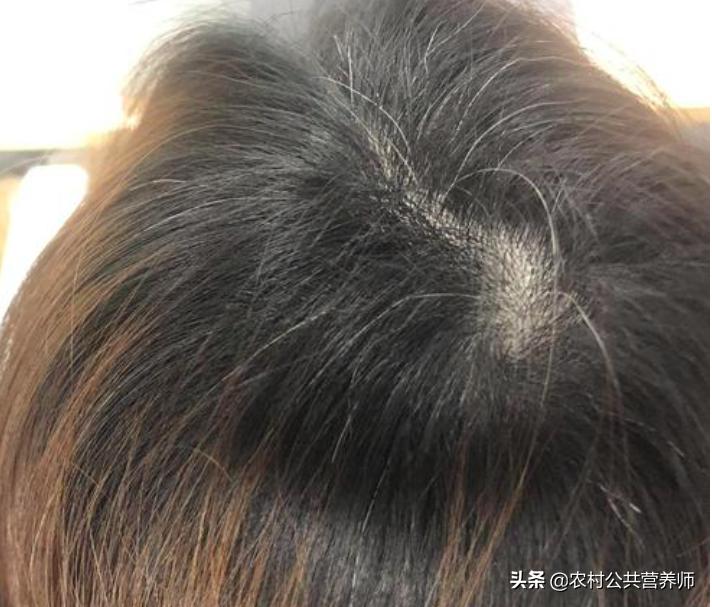 中年人头发乌黑浓密,头发乌黑的中年人