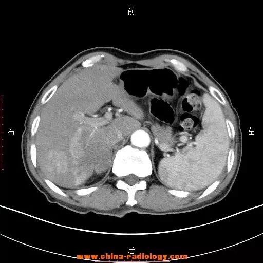 拍了片子拿到结果看不明白？彩虹医生教您看懂影像报告
