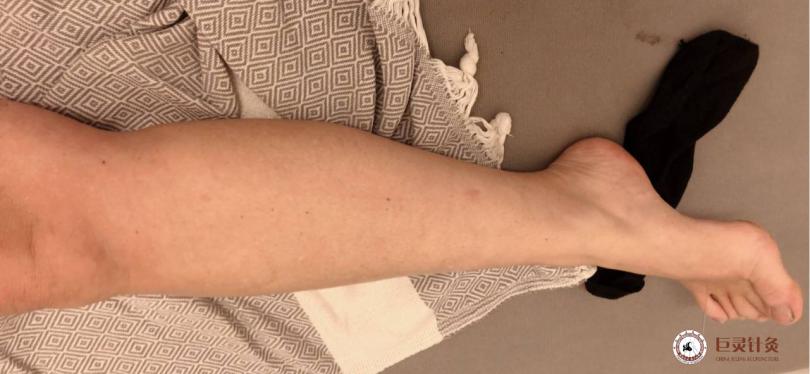 肝郁各个阶段的症状用药,治疗肝郁的中药有什么副作用