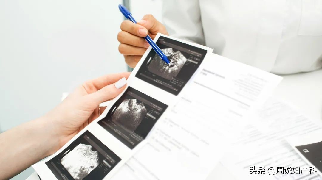 受孕男宝宝喝苏打水有用吗,备孕事后垫枕头有用吗