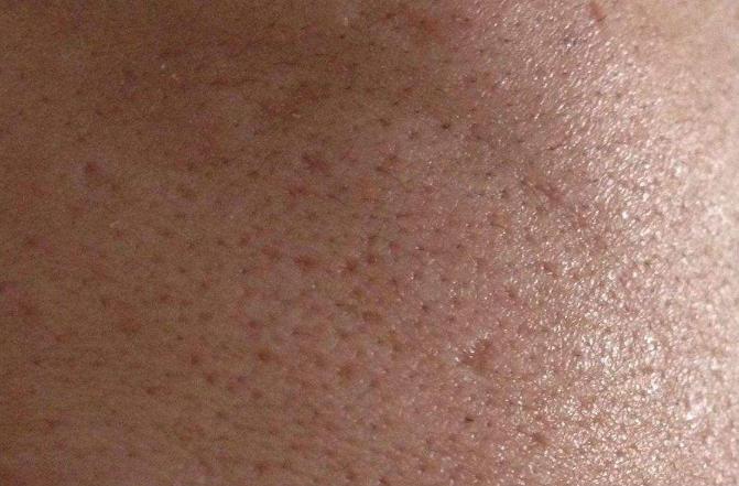 男生毛孔粗大怎么解决用什么面膜,男生脸上皮肤粗糙毛孔粗大怎么办