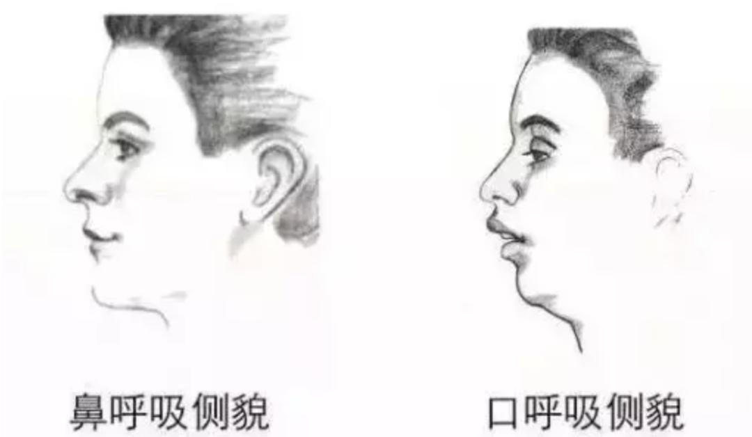 打呼噜会要命吗,打呼噜的危害你远远想不到