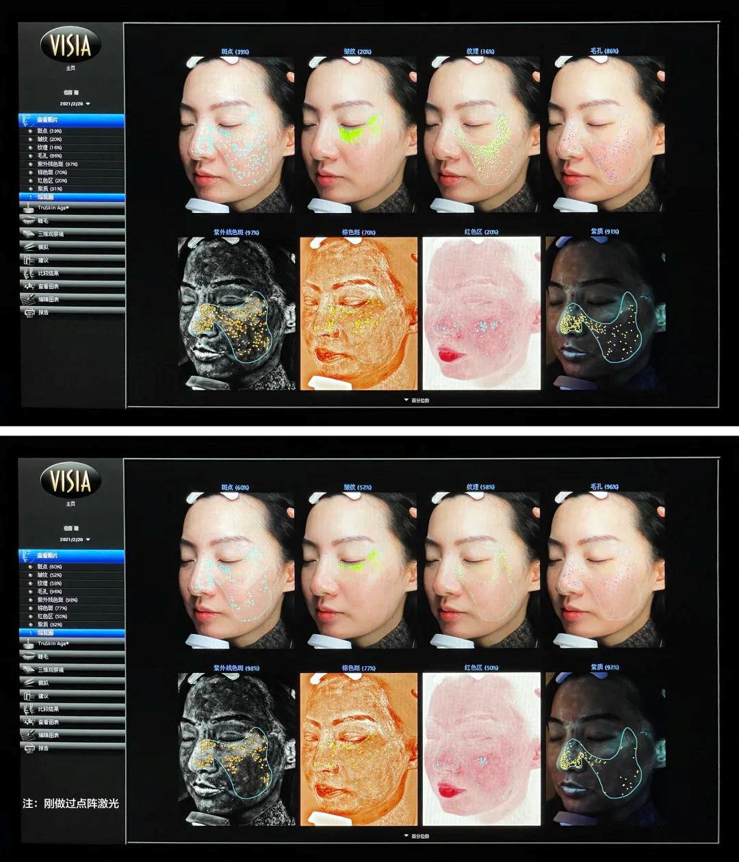 碧欧泉美白祛皱,碧欧泉美白抗老