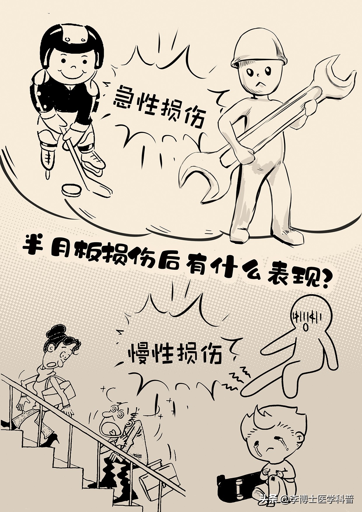 半月板平时注意事项怎样恢复更快,半月板深度科普