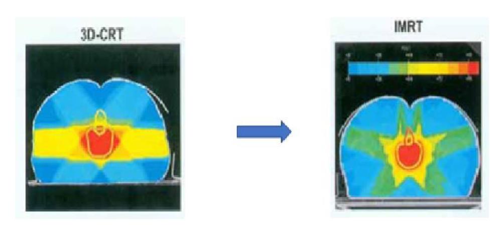 医用粒子加速器,医用加速器的原理