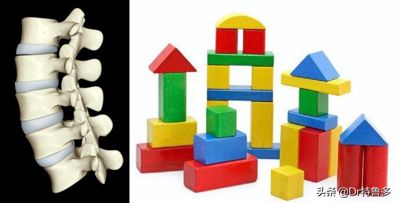 青少年腰痛,小心误诊,也有可能是得了一种“老人病”