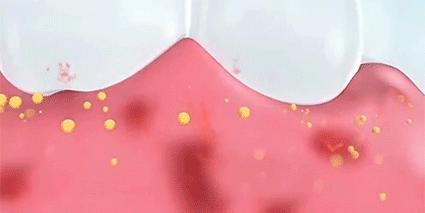 刷牙去牙垢烟垢黄牙最有效方法,刷牙多久才能消除牙黄味