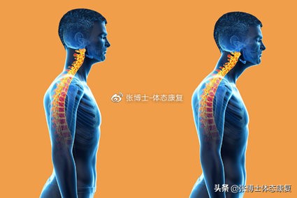 颈部僵硬康复训练方法,怎样缓解肩颈僵硬情绪紧张