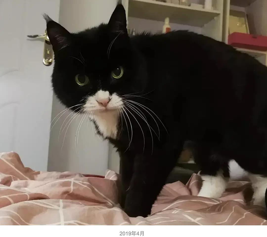 糖尿病患者胆囊炎胰腺炎同时出现,胆囊结石胰腺炎糖尿病