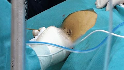 针尖上的艺术——周晓东和他的“超声文化”