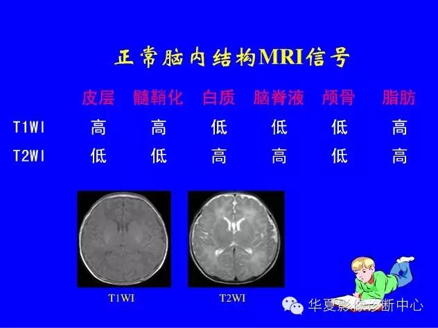 新生儿颅脑mri,新生儿颅脑mr报告模板