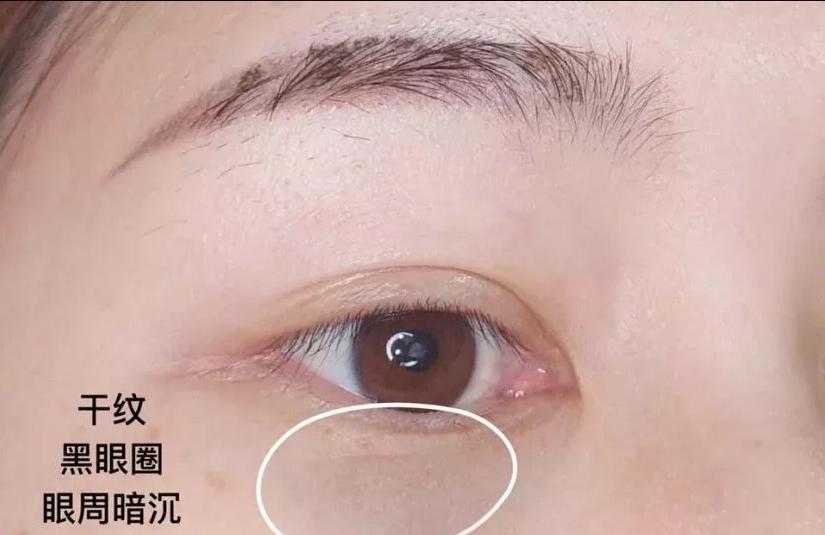 兰蔻和雅诗兰黛小棕瓶眼霜哪个好,雅诗兰黛小棕瓶眼霜和兰蔻哪款好