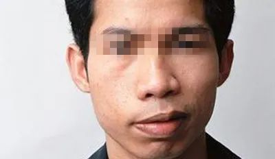 空调风扇引起的面瘫能恢复吗,为什么开空调会导致面瘫