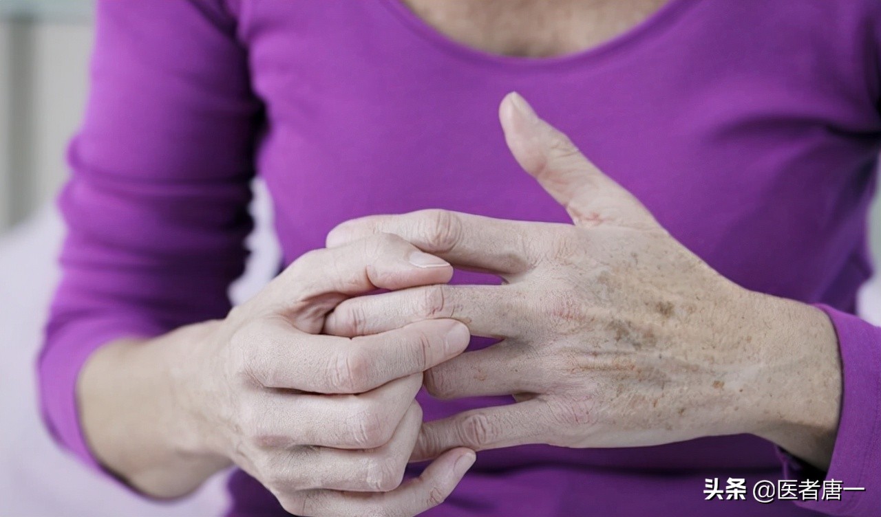 50多岁女性手指腱鞘炎怎么治,59岁女性容易发腱鞘炎应注意什么