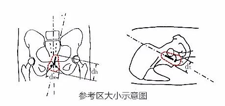 近距离放疗的副作用,近距离放疗