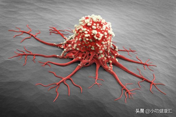 卡博替尼的副作用及处理办法,卡博替尼是什么药