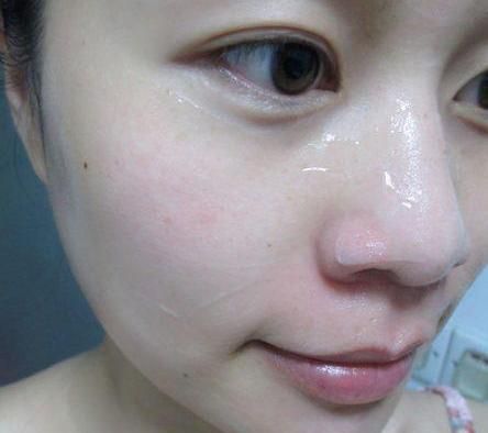 祛一个斑最有效方法激光还是嫩肤,什么斑适合做激光祛斑