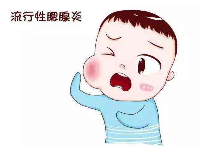 腮腺炎民间治疗,有什么药可以治疗腮腺炎