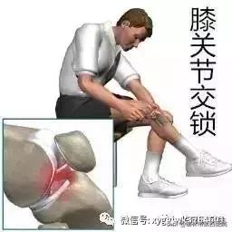 内侧半月板后角损伤怎么治疗,prp治疗半月板损伤有用吗