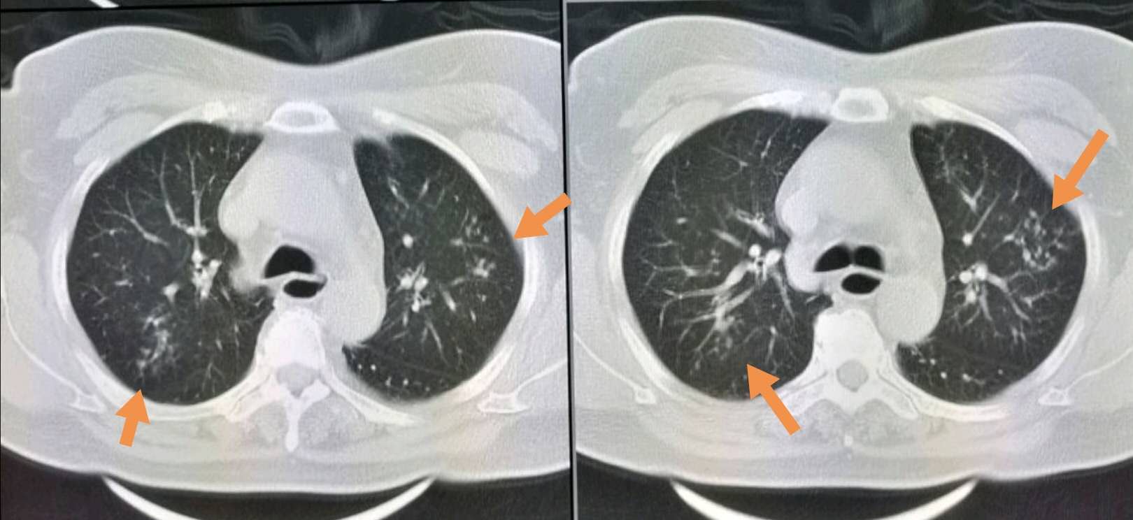 过年喝酒小酌怡情莫要贪杯,春节喝酒喝多了想吐怎么办