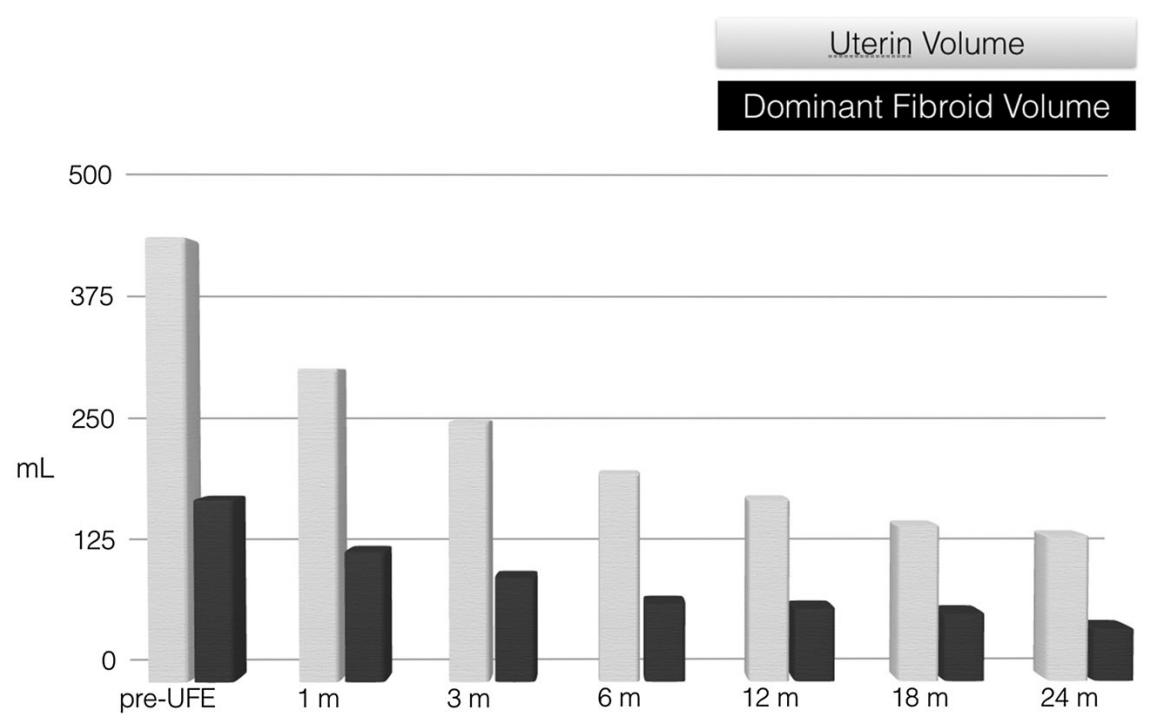 子宫肌瘤介入栓塞术排出黄水,子宫肌瘤介入消融治疗