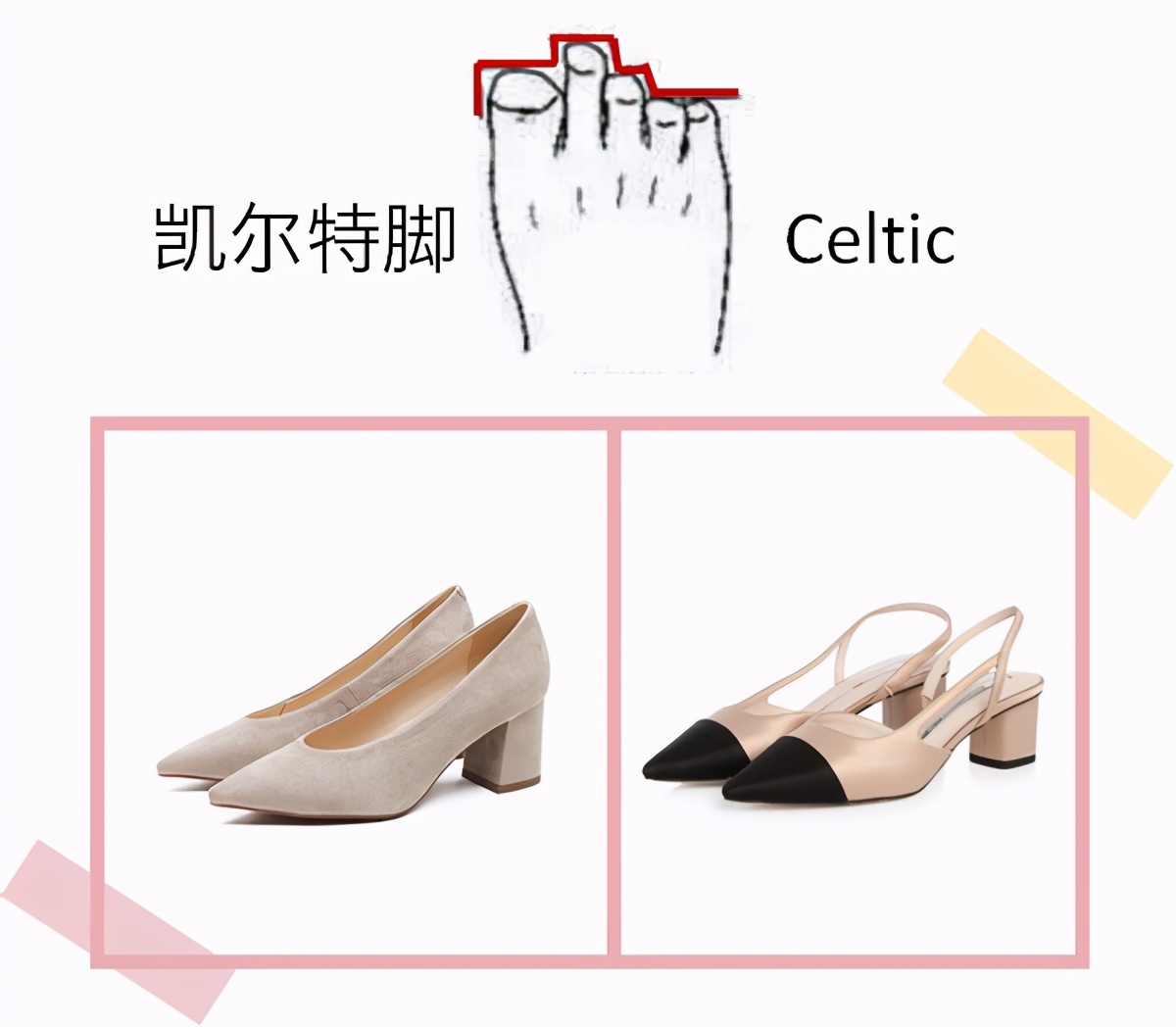 x型腿埃及脚适合哪种高跟鞋,尖的高跟鞋适合哪种脚型