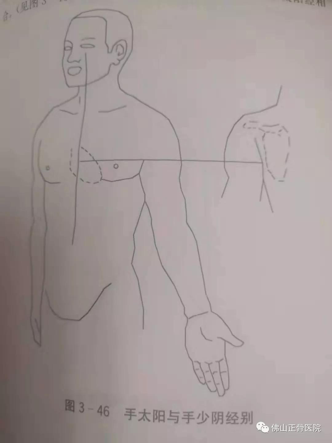 经筋手法，我院名誉院长国医大师韦贵康《韦氏骨伤手法集成》