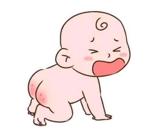 宝宝红屁股护理干货,4个月宝宝红屁股怎么办