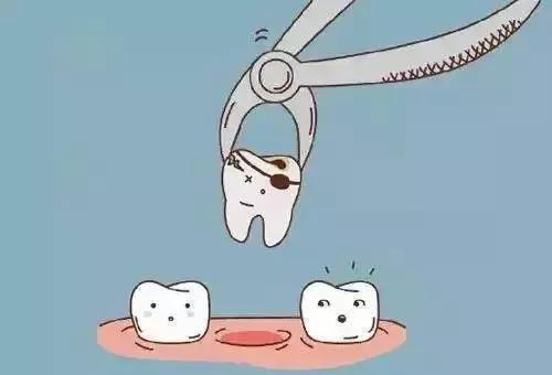 痛得拔光一排牙！解决炸裂“天下第一痛”一根套管针显乾坤