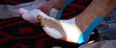 马拉松胸部流血,跑完马拉松胸部会不会出血