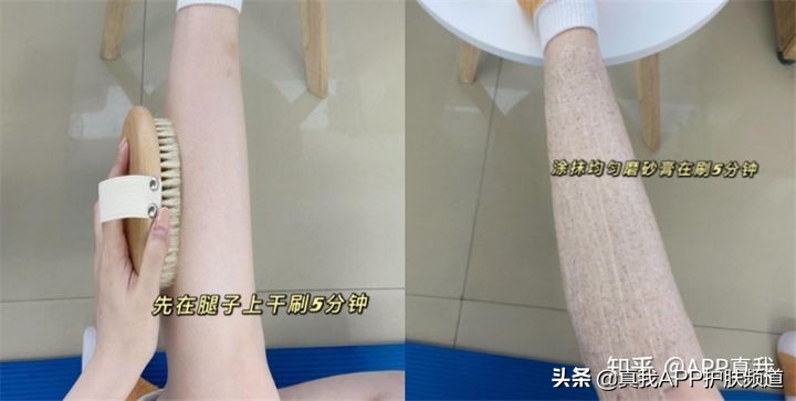 去鸡皮肤真实有效的方法,鸡皮肤如何彻底治愈