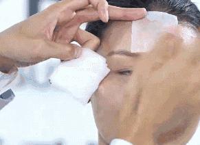 闭口挤了一直长怎么办,闭口到底要不要挤出来