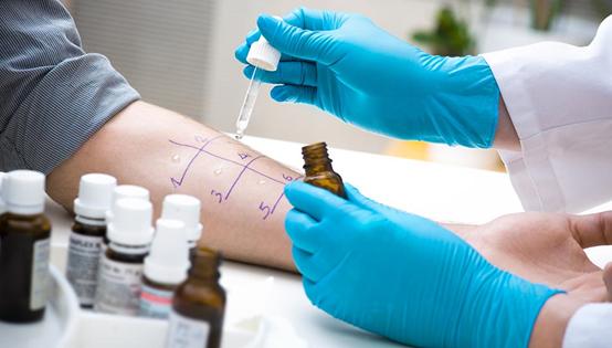 皮肤对化学品过敏用什么药,皮肤化学品过敏怎么办