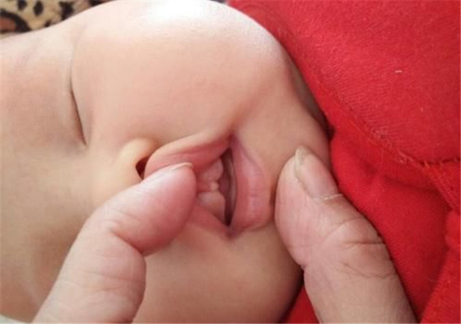 3岁孩子频繁嘟嘴,三岁小孩老嘟嘴