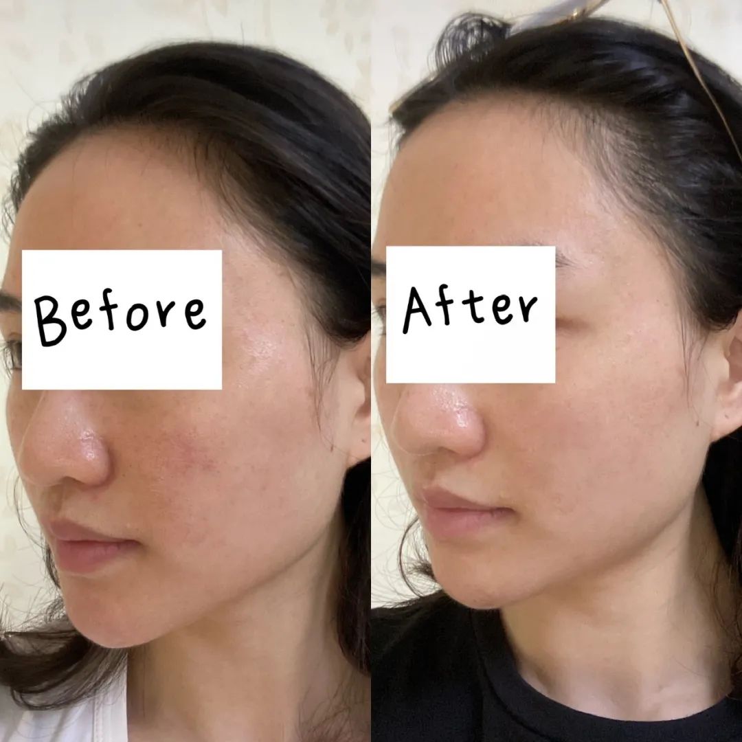 有没有免费做的医美项目,医美项目亲身经历