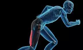 腘绳肌拉伤二级拉伤,腘绳肌拉伤如何判断是肌腱拉伤