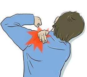 你真的了解肩周炎,肩周炎一般都是怎么得上的