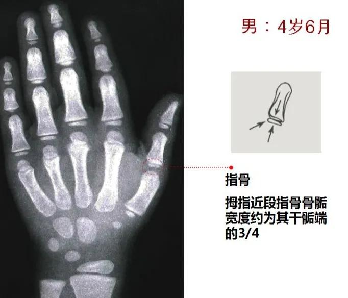 孩子个子高却跑不快,小孩个头不高